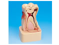 牙齿病变综合病理分解模型